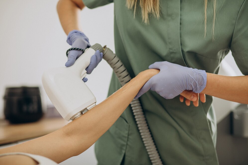 Laser hair removal
